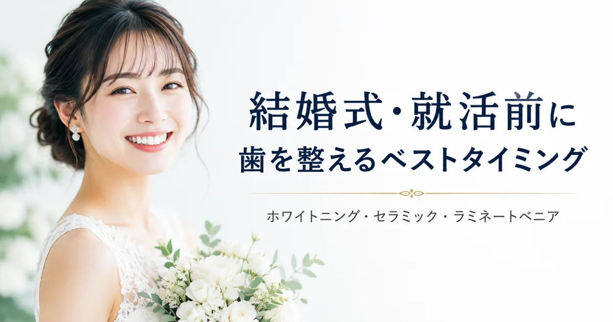 結婚式・就活・転職前に知りたい審美治療のベストタイミング|コラムのアイキャッチ画像