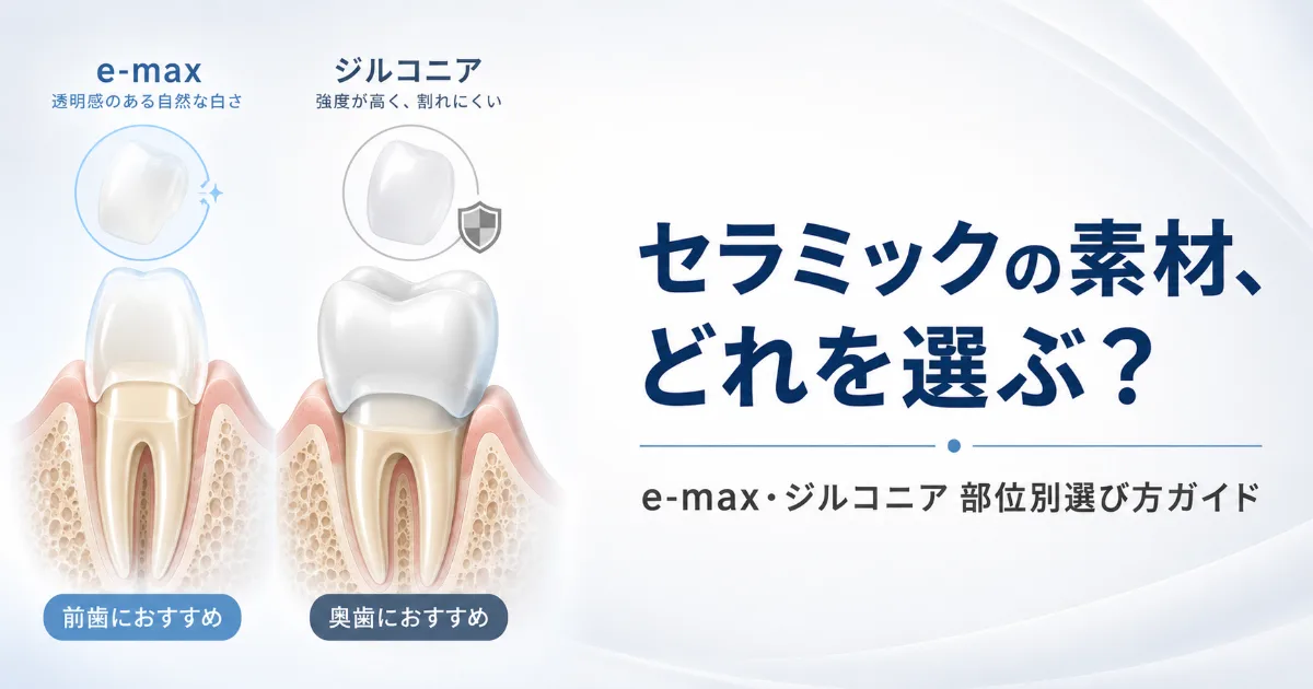 セラミックの素材どれを選ぶ?e-max・ジルコニア・部位別の選び方ガイド|コラムのアイキャッチ画像