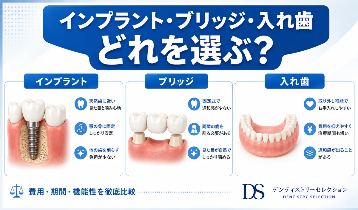 インプラント・ブリッジ・入れ歯の違いを徹底比較|費用・期間・選び方ガイド|コラムのアイキャッチ画像