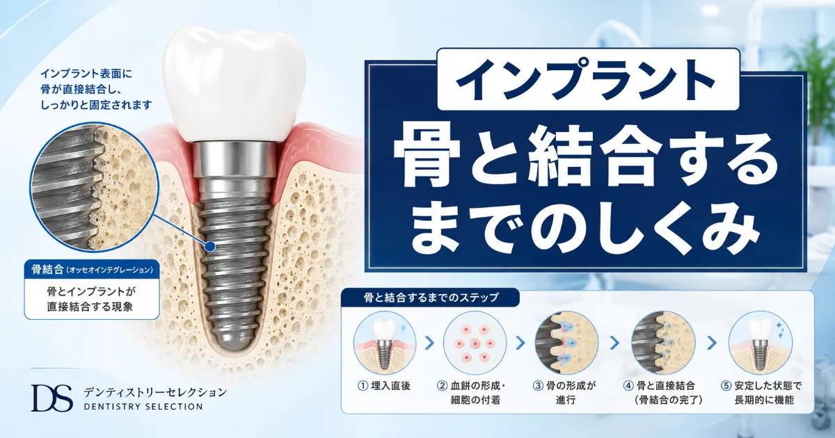 インプラントが骨と結合する仕組みとは?骨結合期間中の注意点を解説|コラムのアイキャッチ画像