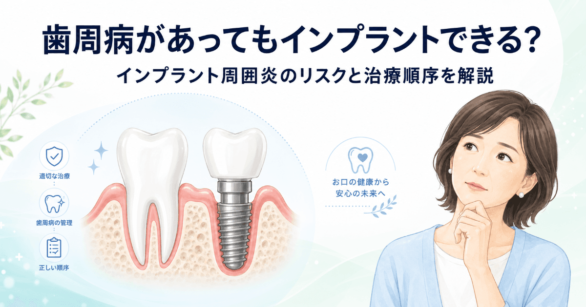 歯周病があってもインプラントはできる?インプラント周囲炎のリスクと治療の順番を解説|コラムのアイキャッチ画像