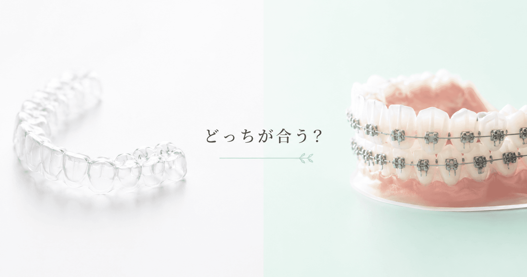 マウスピース矯正とワイヤー矯正、どっちがいい?費用・特徴・向いている人を徹底比較|コラムのアイキャッチ画像