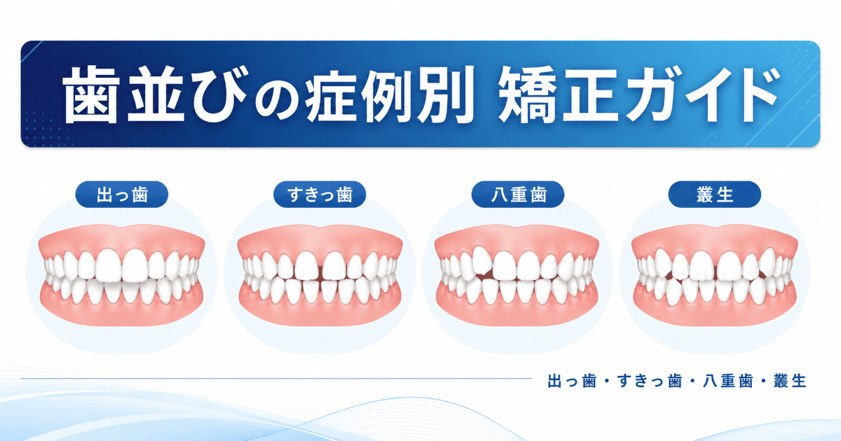 歯並びの症例別矯正ガイド|出っ歯・すきっ歯・八重歯・叢生の治し方と費用|コラムのアイキャッチ画像
