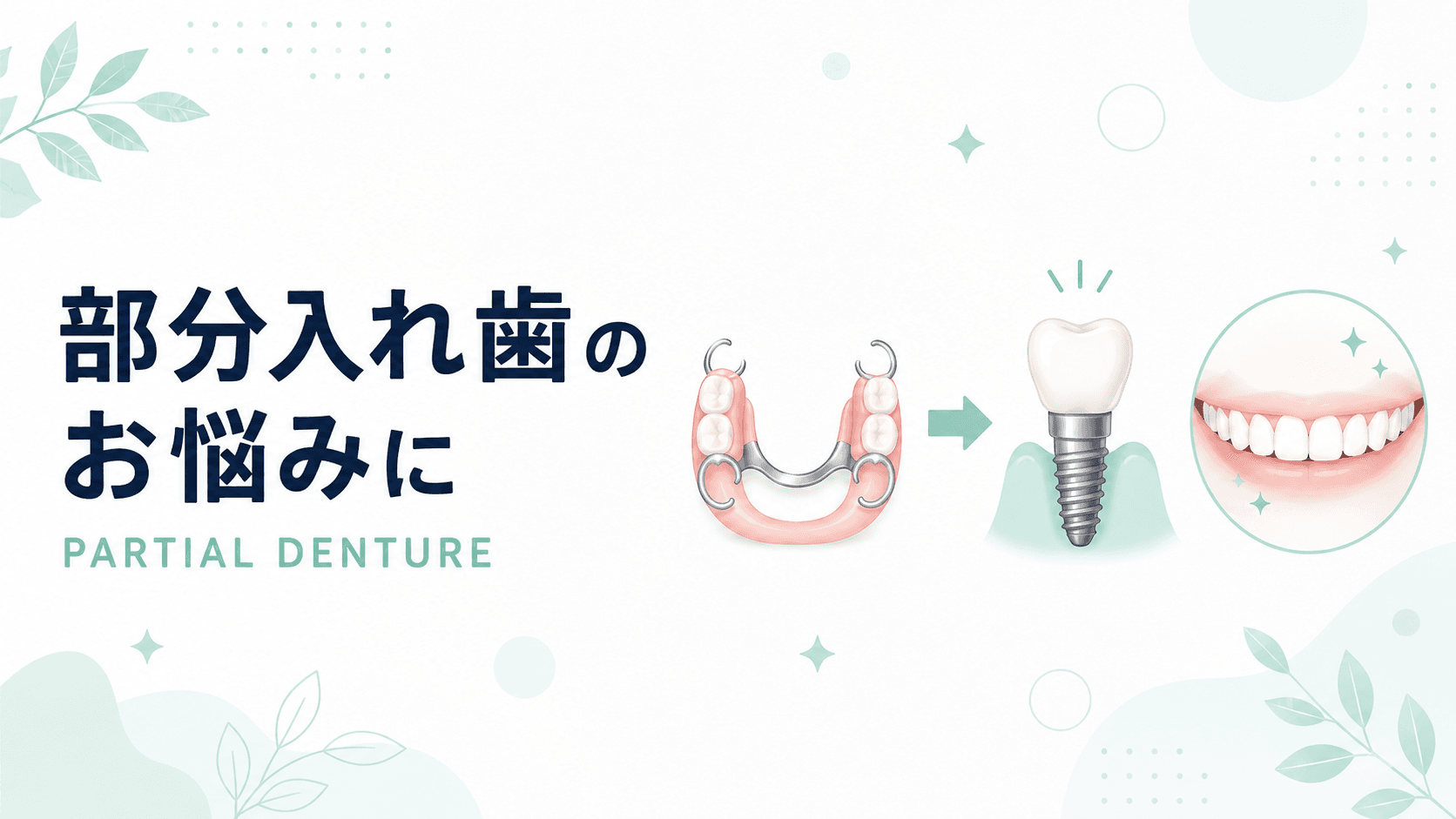 部分入れ歯の違和感でお悩みの方へ|インプラント治療という選択肢|コラムのアイキャッチ画像