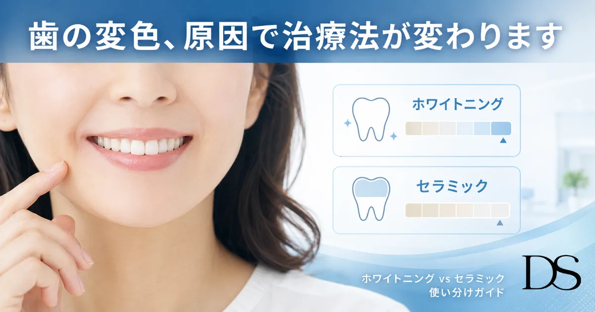 歯の変色、原因によって治療法は変わる?ホワイトニングとセラミックの使い分けガイド|コラムのアイキャッチ画像