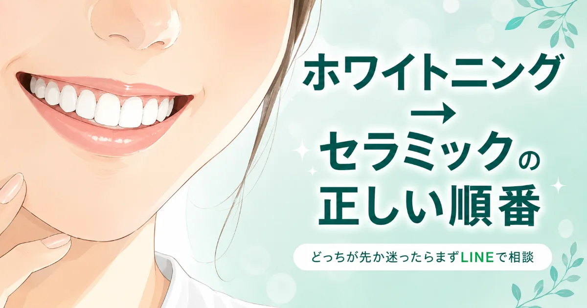 ホワイトニング+セラミック、どっちが先?組み合わせ治療の正しい順番と費用計画|コラムのアイキャッチ画像